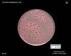 Escherichia coli on MacConkey